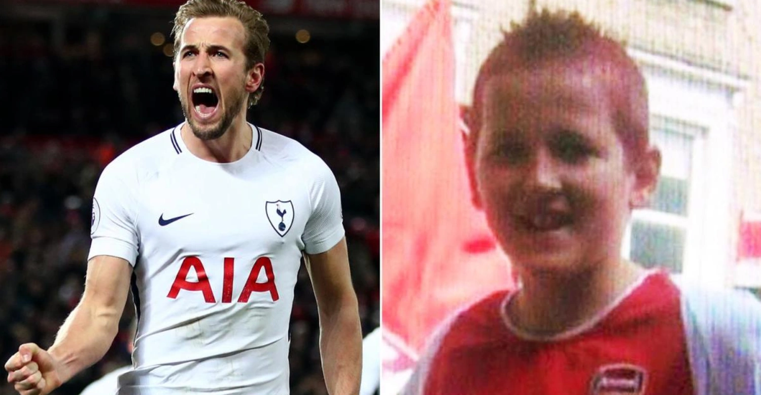Harry Kane before and after